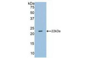 Detection of Recombinant DUSP3, Human using Polyclonal Antibody to Dual Specificity Phosphatase 3 (DUSP3)