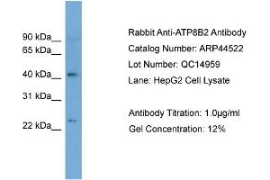 WB Suggested Anti-ATP8B2  Antibody Titration: 0. (ATP8B2 抗体  (N-Term))