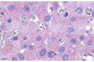 Immunohistochemical (Formalin/PFA-fixed paraffin-embedded sections) staining in human ovary with PTGFR polyclonal antibody . (PTGFR 抗体  (2nd Cytoplasmic Domain))