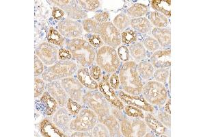 Immunohistochemistry of paraffin-embedded mouse kidney using KRAS Rabbit pAb (ABIN3021676, ABIN3021677, ABIN3021678, ABIN1513137 and ABIN1514282) at dilution of 1:150 (40x lens). (K-RAS 抗体)