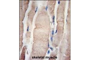 Formalin-fixed and paraffin-embedded human skeletal muscle tissue reacted with PHPT1 Antibody (N-term) (ABIN389182 and ABIN2839345) , which was peroxidase-conjugated to the secondary antibody, followed by DAB staining. (PHPT1 抗体  (C-Term))