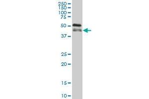 RBM9 monoclonal antibody (M02), clone 5E11 Western Blot analysis of RBM9 expression in A-431 . (RBM9 抗体  (AA 1-100))
