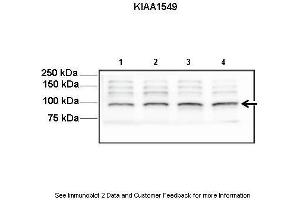 Lanes:   Lane1-4: 30ug mouse neurosphere lysate  Primary Antibody Dilution:   1:1000  Secondary Antibody:   Anti-rabbit HRP  Secondary Antibody Dilution:   1:5000  Gene Name:   KIAA1549  Submitted by:   Yi-Hsien Chen, Washington University School of Medicine (KIAA1549 抗体  (C-Term))