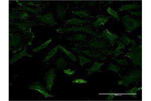 Immunofluorescence of monoclonal antibody to MAGI1 on HeLa cell. (MAGI1 抗体  (AA 761-859))