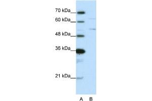 WB Suggested Anti-HNRPK Antibody Titration:  0. (HNRNPK 抗体  (N-Term))