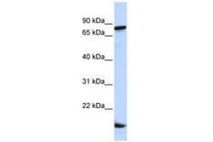 Image no. 1 for anti-Zinc Finger Protein 281 (ZNF281) (C-Term) antibody (ABIN6740570) (ZNF281 抗体  (C-Term))