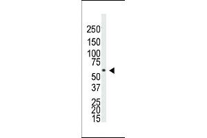 Western blot analysis of anti-BR1A Pab ap2004a in Saos-2 cell lysate. (BMPR1A 抗体  (N-Term))