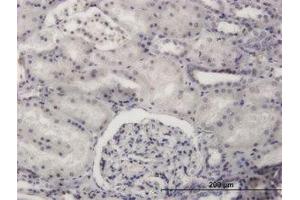 Image no. 1 for anti-PR Domain Containing 4 (PRDM4) (AA 476-576) antibody (ABIN599168) (PRDM4 抗体  (AA 476-576))