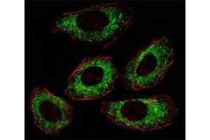 Fluorescent image of A549 cell stained with anti-Src antibody at 1:25. (Src 抗体)