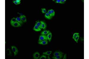 Immunofluorescence staining of HepG2 cells with ABIN7158130 at 1:133, counter-stained with DAPI. (LGR5 抗体  (AA 241-352))