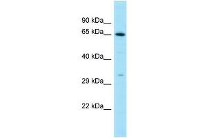 Western Blotting (WB) image for anti-Luteinizing Hormone/Choriogonadotropin Receptor (LHCGR) (C-Term) antibody (ABIN2788657) (LHCGR 抗体  (C-Term))