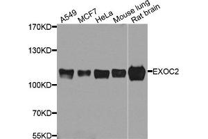 Western blot analysis of extract of various cells, using EXOC2 antibody. (EXOC2 抗体)
