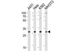 Western Blotting (WB) image for anti-Cyclin-Dependent Kinase 5 (CDK5) (AA 254-289) antibody (ABIN3030614)