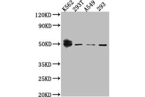 Western Blot Positive WB detected in: K562 whole cell lysate, 293T whole cell lysate, A549 whole cell lysate, HEK293 whole cell lysate All lanes: Wilms Tumor Protein antibody at 1:1000 Secondary Goat polyclonal to rabbit IgG at 1/50000 dilution Predicted band size: 50, 48, 48, 49, 35, 57, 56, 34 kDa Observed band size: 50 kDa (Recombinant WT1 抗体)