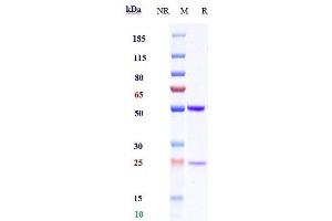 Anti-IL-1b Reference Antibody (CDP484) on SDS-PAGE under reducing (R) condition.
