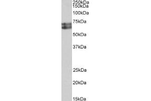 ABIN5539539 (0. (HDC 抗体  (AA 449-462))