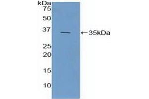 Detection of Recombinant FCN1, Mouse using Polyclonal Antibody to Ficolin 1 (FCN1) (FCN1 抗体  (AA 25-317))