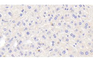 Detection of LOXL2 in Mouse Liver Tissue using Polyclonal Antibody to Lysyl Oxidase Like Protein 2 (LOXL2) (LOXL2 抗体  (AA 53-160))