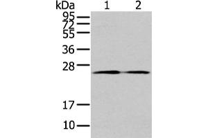 Gel: 12 % SDS-PAGE, Lysate: 40 μg, Lane 1-2: PC3 cell and human colon cancer tissue, Primary antibody: ABIN7192958(TUSC1 Antibody) at dilution 1/200 dilution, Secondary antibody: Goat anti rabbit IgG at 1/8000 dilution, Exposure time: 1 minute (TUSC1 抗体)