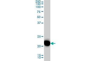 RRAS monoclonal antibody (M01), clone 2E12 Western Blot analysis of RRAS expression in HeLa . (R-Ras 抗体  (AA 109-218))
