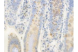 ABIN6258278 and ABIN6273860 at 1/100 staining human normal colon tissue by IHC-P. (GPR20 抗体  (C-Term))