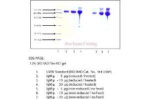 Gel Scan of Immunoglobulin M, mu Chain, Human Plasma  This information is representative of the product ART prepares, but is not lot specific. (IgM 蛋白)