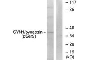 Western blot analysis of extracts from 293 cells treated with PMA 200nM 30', using Synapsin (Phospho-Ser9) Antibody. (SYN1 抗体  (pSer9))