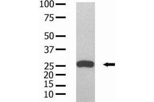 The anti-GST Mab (ABIN387751 and ABIN2843190) is used in Western blot to detect GST recombinant protein purified from bacterial lysate. (GST-Tag 抗体)