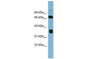 OSGEP antibody used at 1 ug/ml to detect target protein. (OSGEP 抗体  (Middle Region))