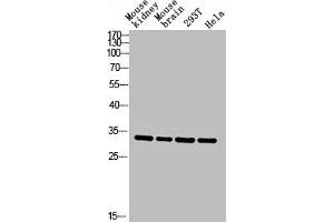 Western blot analysis of Mouse-kidney mouse-brain 293T hela lysis using CA II antibody. (CA2 抗体  (C-Term))