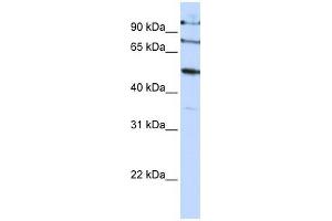 FBXO5 antibody used at 1 ug/ml to detect target protein. (FBXO5 抗体  (C-Term))