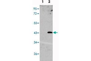 Western blot analysis of UNQ1887 (arrow) using UNQ1887 polyclonal antibody . (UNQ1887 (N-Term) 抗体)