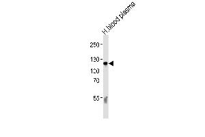Western blot analysis of lysate from human blood plasma tissue lysate, using C6 Antibody (N-term) (ABIN390924 and ABIN2841126). (C6 抗体  (N-Term))