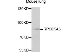 Western blot analysis of extracts of mouse lung, using RPS6KA3 antibody.