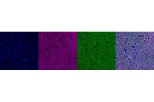 Immunohistochemistry (IHC) image for anti-Insulin-Like Growth Factor Binding Protein 6 (IGFBP6) antibody (ABIN7455978) (IGFBP6 抗体)