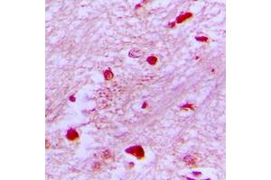 Immunohistochemical analysis of E2F2 staining in human brain formalin fixed paraffin embedded tissue section. (E2F2 抗体  (Center))