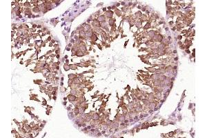 Paraformaldehyde-fixed, paraffin embedded Mouse testis Antigen retrieval by boiling in sodium citrate buffer (pH6.