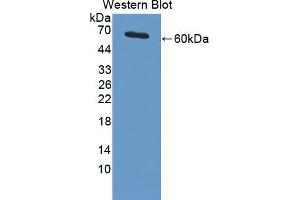 Western blot analysis of the recombinant protein. (PIAS3 抗体  (AA 11-280))