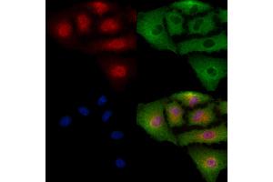 Phospho-VEGFR3 (Tyr1230) Antibody staining A549 cells(4h of LPS treatment) by IF/ICC. (FLT4 抗体  (pTyr1230))