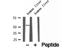 Western blot analysis of extracts of human liver tissue, using TRIM44 antibody. (TRIM44 抗体  (Internal Region))