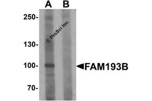 Western Blotting (WB) image for anti-Family with Sequence Similarity 193, Member B (FAM193B) (N-Term) antibody (ABIN1587943)