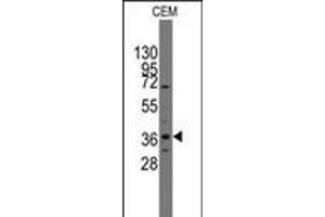 Western blot analysis of anti-Pilx2 Pab in CEM cell line lysates (35ug/lane).