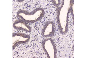 IHC analysis of IDE using anti-IDE antibody . (IDE 抗体  (AA 485-756))