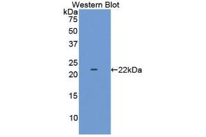 Western blot analysis of the recombinant protein. (LAMC2 抗体  (AA 28-196))