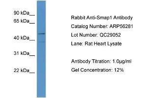 WB Suggested Anti-LOC684800  Antibody Titration: 0. (SMAP1 抗体  (N-Term))