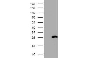 Western Blotting (WB) image for anti-Hydroxysteroid (17-Beta) Dehydrogenase 8 (HSD17B8) (AA 57-261) antibody (ABIN2715556) (HSD17B8 抗体  (AA 57-261))