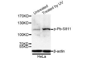 Western blot analysis of extracts of 293 and HeLa cells, using Phospho-Rb-S811 antibody. (Retinoblastoma 1 抗体  (pSer811))