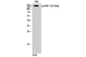 Western Blotting (WB) image for anti-Glucocorticoid Receptor DNA Binding Factor 1 (GRLF1) (pTyr1105) antibody (ABIN3182521) (GRLF1 抗体  (pTyr1105))