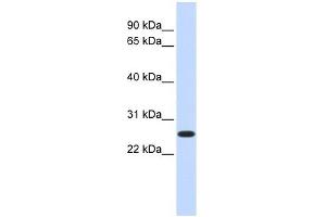 DULLARD antibody used at 1 ug/ml to detect target protein.