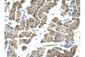 ACVR1 antibody was used for immunohistochemistry at a concentration of 4-8 ug/ml to stain Skeletal muscle cells (arrows) in Human Muscle. (ACVR1 抗体  (N-Term))